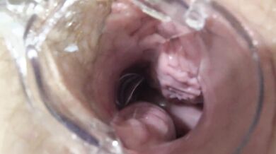 Mature lesbians play in a gynecologist, open the vagina with a medical dilator, examine the cervix.