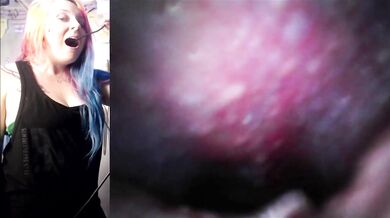 Vore Endoscopy