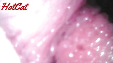 Endoscopic vaginal observation