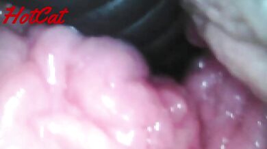 Endoscopic vaginal observation