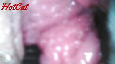 Endoscopic vaginal observation