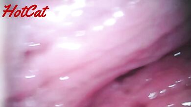 Endoscopic vaginal observation