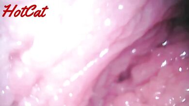 Endoscopic vaginal observation