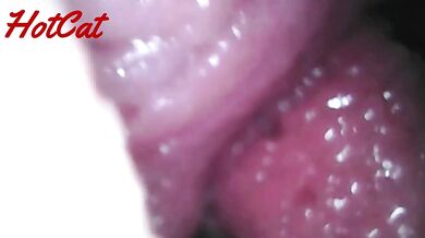 Endoscopic vaginal observation