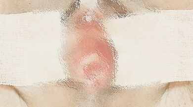 It wasn't able to penetrate, but it penetrated quite deep. It felt really good to use the electri