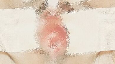 It wasn't able to penetrate, but it penetrated quite deep. It felt really good to use the electri