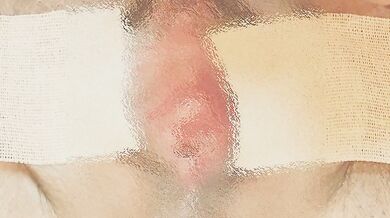 It wasn't able to penetrate, but it penetrated quite deep. It felt really good to use the electri