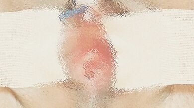 It wasn't able to penetrate, but it penetrated quite deep. It felt really good to use the electri