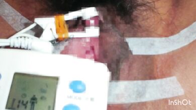 クリトリス 電気責め 吸引