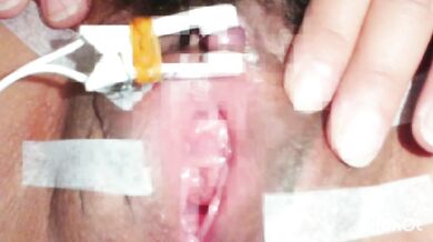 クリトリス 電気責め 吸引