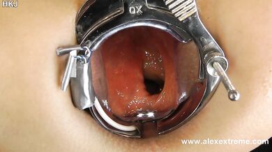 Incredible deep anal view with XO speculum and light in Hotkinkyjo ass