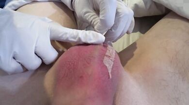 1 DAY: The doctor was surprised by the patient. Hospital
