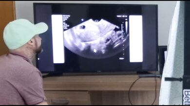 Cuckold takes wife to get an ultrasound with a private gynecologist!