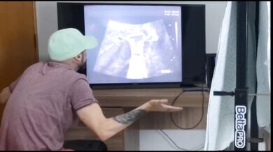 Cuckold takes wife to get an ultrasound with a private gynecologist!