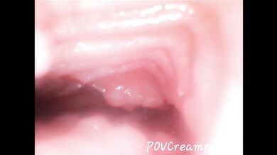 Endoscope Creampie. Cam Inside Pussy Shows Dick Cumming Inside Pussy