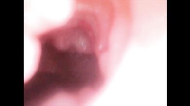 Endoscope Creampie. Cam Inside Pussy Shows Dick Cumming Inside Pussy
