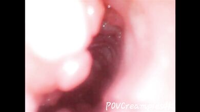 Endoscope Creampie. Cam Inside Pussy Shows Dick Cumming Inside Pussy