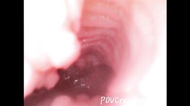 Endoscope Creampie. Cam Inside Pussy Shows Dick Cumming Inside Pussy