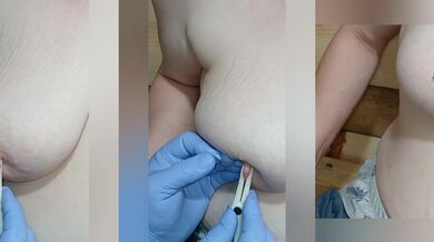 Extreme Nipple Play
