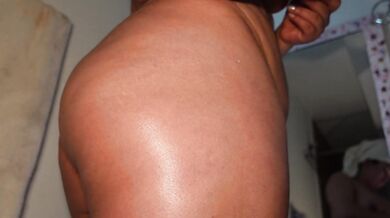 The chubby girl applies oil and creams after showering