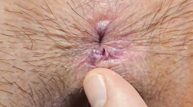 BBW Cares for her Hemorrhiod