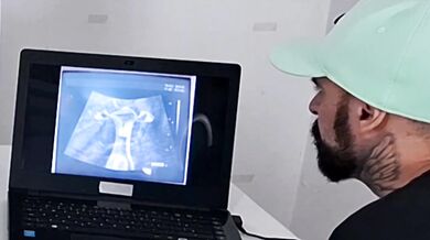 Ginecologista faz ultrassonografia diferente na esposa do corno!