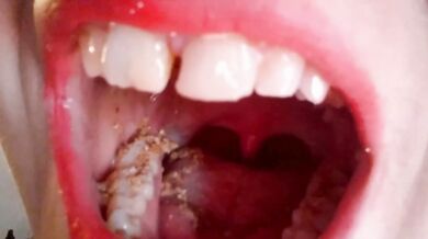 Crushed like an insect giantess chews you alive raw teeth and bones