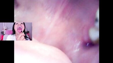 Lila Jordan Mini Cam Vore Endoscope Throat Fucked Brace Clamped Inside OnlyFans