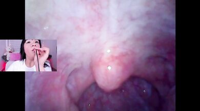 Lila Jordan Mini Cam Vore Endoscope Throat Fucked Brace Clamped Inside OnlyFans
