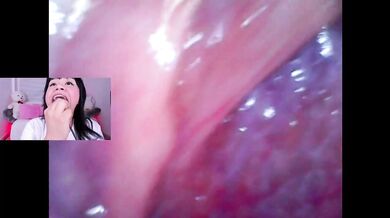 Lila Jordan Mini Cam Vore Endoscope Throat Fucked Brace Clamped Inside OnlyFans