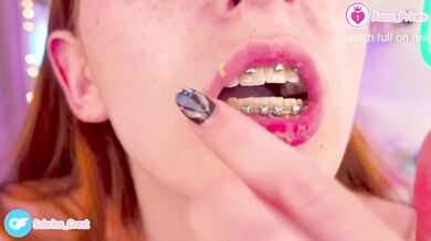Messy Boogers and Braces Naughty Hot Tease