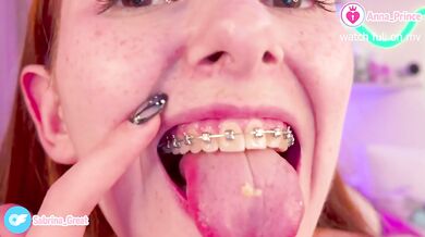 Messy Boogers and Braces Naughty Hot Tease