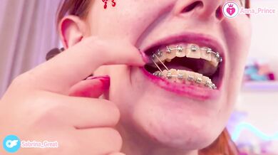 Cute Petite Redhead With Braces Teases Naked Ass Up Close