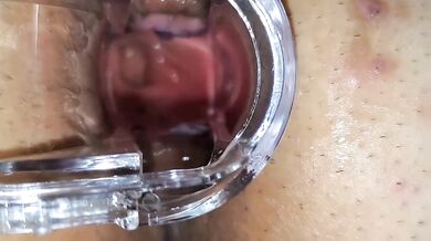 BBW Wife Extreme Anal Speculum Gape Destroyed