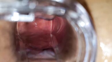 BBW Wife Extreme Anal Speculum Gape Destroyed
