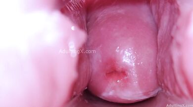 Cervix Display and Speculum Play