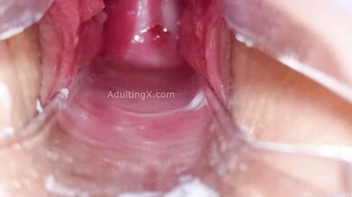 Cervix Display and Speculum Play