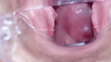 Cervix Display and Speculum Play