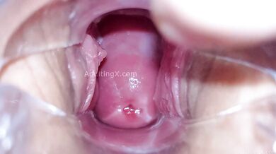 Cervix Display and Speculum Play