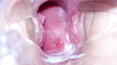 Cervix Display and Speculum Play
