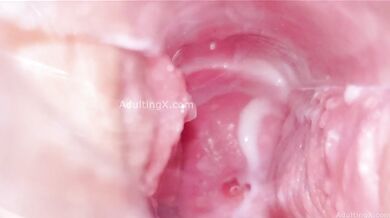 Cervix Display and Speculum Play