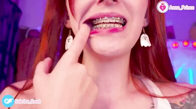 Gushing Braces Close Up Red Head Slim Teen Naughty Cute
