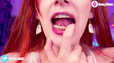 Gushing Braces Close Up Red Head Slim Teen Naughty Cute