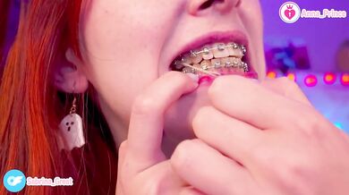 Gushing Braces Close Up Red Head Slim Teen Naughty Cute