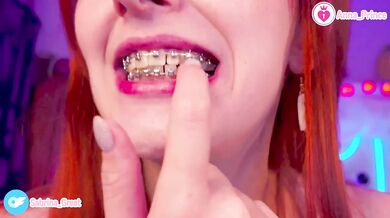 Gushing Braces Close Up Red Head Slim Teen Naughty Cute