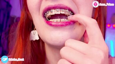 Gushing Braces Close Up Red Head Slim Teen Naughty Cute