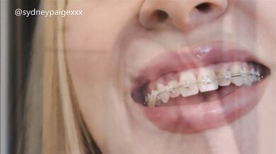 Sydney Paige Teases You to Cum All Over Her Braces