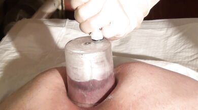 Femdom ass treatment with the vacuum pump