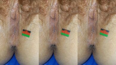 Malawi